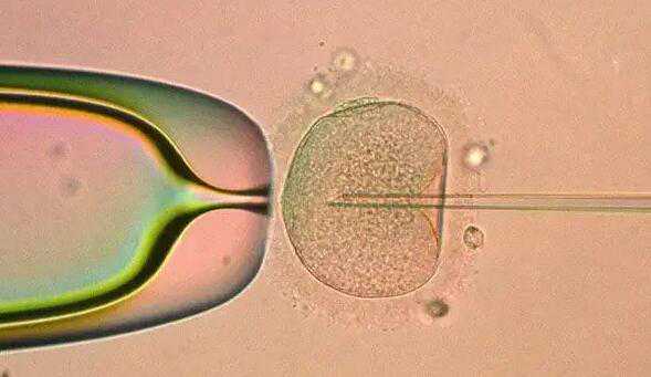 试管二代能选择性别吗_试管双胞胎龙凤胎几率有多大_5天的囊胚4bb好还是6天的